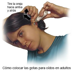 Cómo colocar las gotas para oídos en adultos