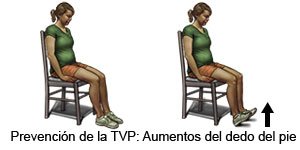 Prevención de la TVP Aumento del dedo del pie