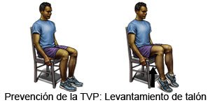 Prevención TVP Levantamiento de talón