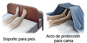 Soporte para pies y arco de protección para cama en casos de THA (artroplastia de cadera)