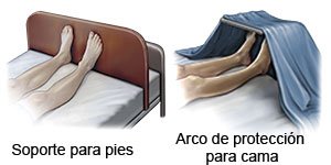 Forma De Usar Arcos De Cama Y Estribos Care Guide Information En