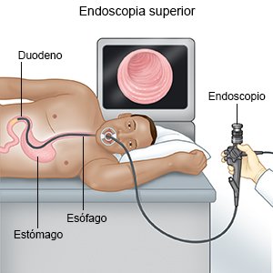 Endoscopia superior