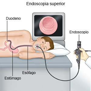 Endoscopia superior (niño)
