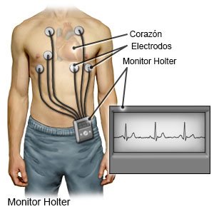 Monitor Holter