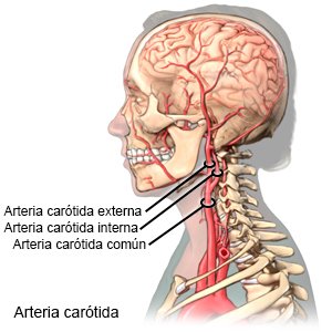 Arteria carótida