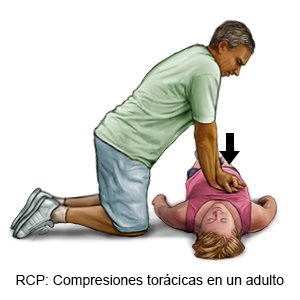 Compresión torácica en un adulto