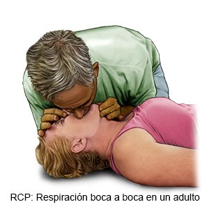 Reanimación Cardiopulmonar En Adultos Por Persona Sin Capacitación Care Guide Information En Espanol