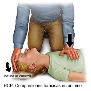 Compresiones torácicas en un niño