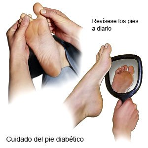 Cuidado del pie diabético