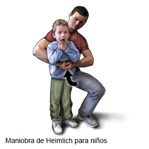 Maniobra de Heimlich para niños