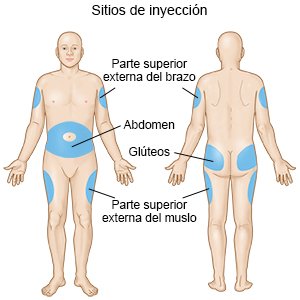 Sitios de inyección