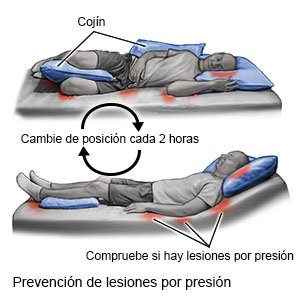 Prevención de lesiones por presión