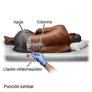 Punción lumbar en adultos