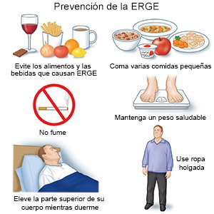 Prevención de la ERGE