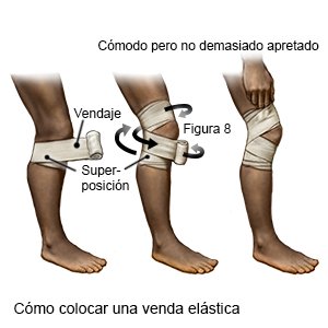 Fuente Menos auricular Esguince De Rodilla Care Guide Information En Espanol