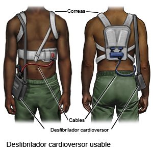 Desfibrilador cardioversor usable