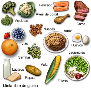 Dieta libre de gluten