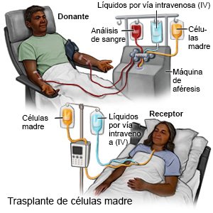 Trasplante de células madre