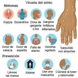 Mpox (Viruela del simio)