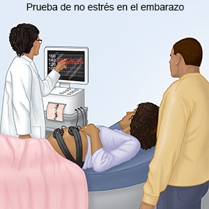 Prueba de no estrés en el embarazo