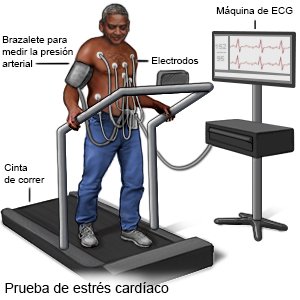 Prueba de estrés cardíaco