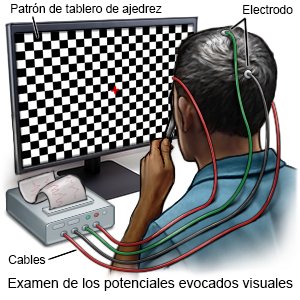 Examen de los potenciales evocados visuales