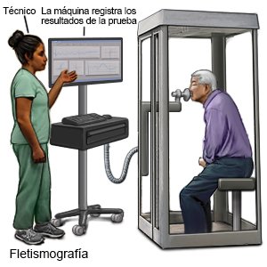 Fletismografía