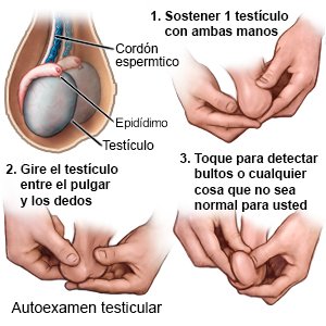 Autoexamen testicular