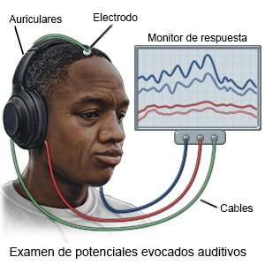 Examen de potenciales evocados auditivos