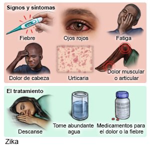 Signos, síntomas y tratamiento del Zika