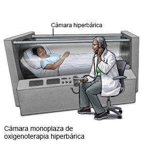 Cámara monoplaza de oxigenoterapia hiperbárica