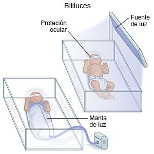 Bililuces