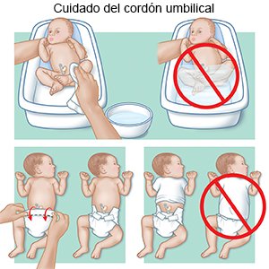 Cuidado del cordón umbilical