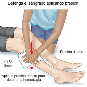 Detenga el sangrado aplicando presión