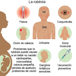 La rubéola