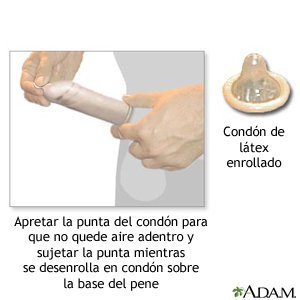 Los aumentos del pene sin operaciones