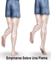 Picture of Achilles tendon one leg heel raise