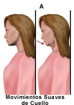 Picture of neck glide exercise