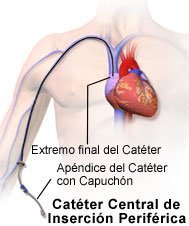 ¿Qué sucede cuando el aire entra en una línea intravenosa?