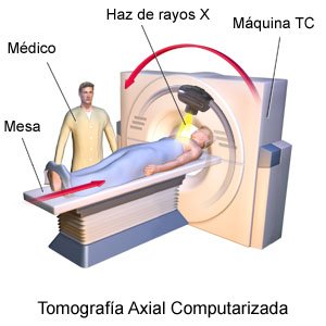 Computerized Axial Tomography Scan