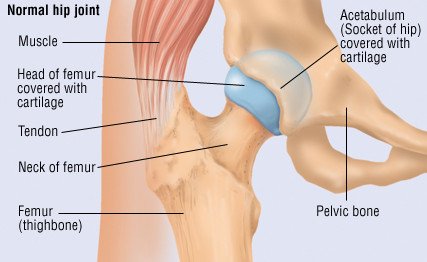 Traumatic Dislocation of the Hip