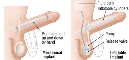 How To Keep My Dick Hard