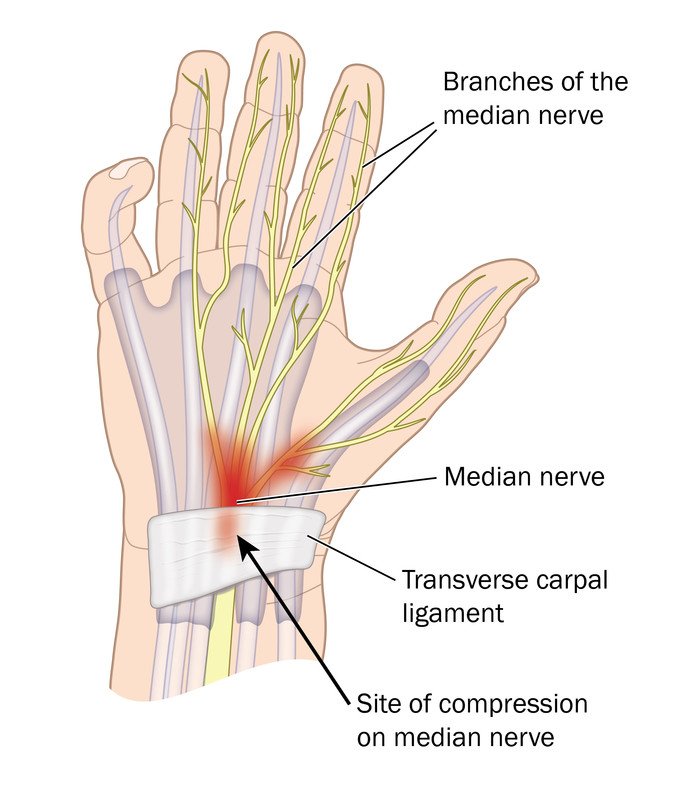 Why your FINGER INJURY WON'T HEAL and HOW TO FIX IT (Pain is Good) - YouTube