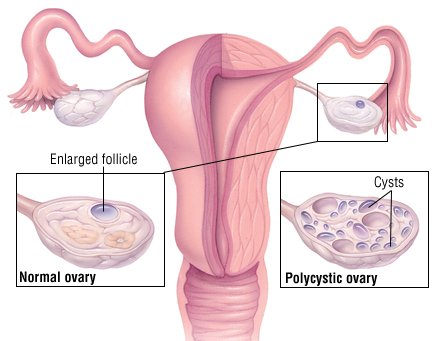 Abnormal testosterone levels