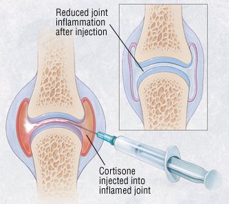 What are corticosteroid medications used for