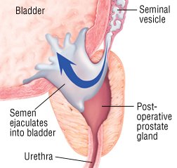 Female orgasm health ejaculations