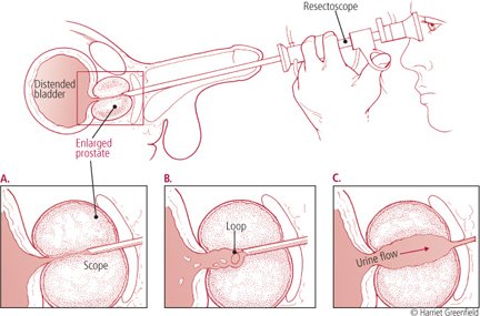 How To Make Sperm Come Out Of Penis 50