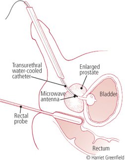 What does an inflamed prostate indicate?