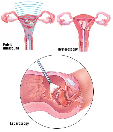 what causes spotting after your period