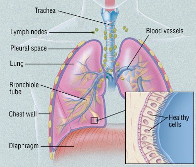 Who is most likely to get lung cancer?